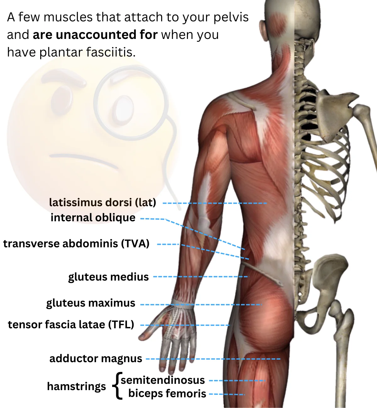 Tensor plantar clearance fasciitis